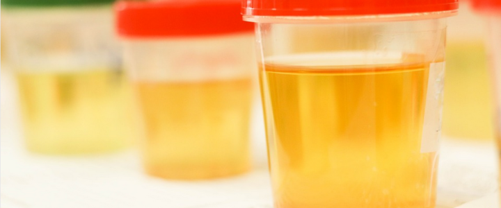 Tips for Buying Synthetic Urine for Drug Test